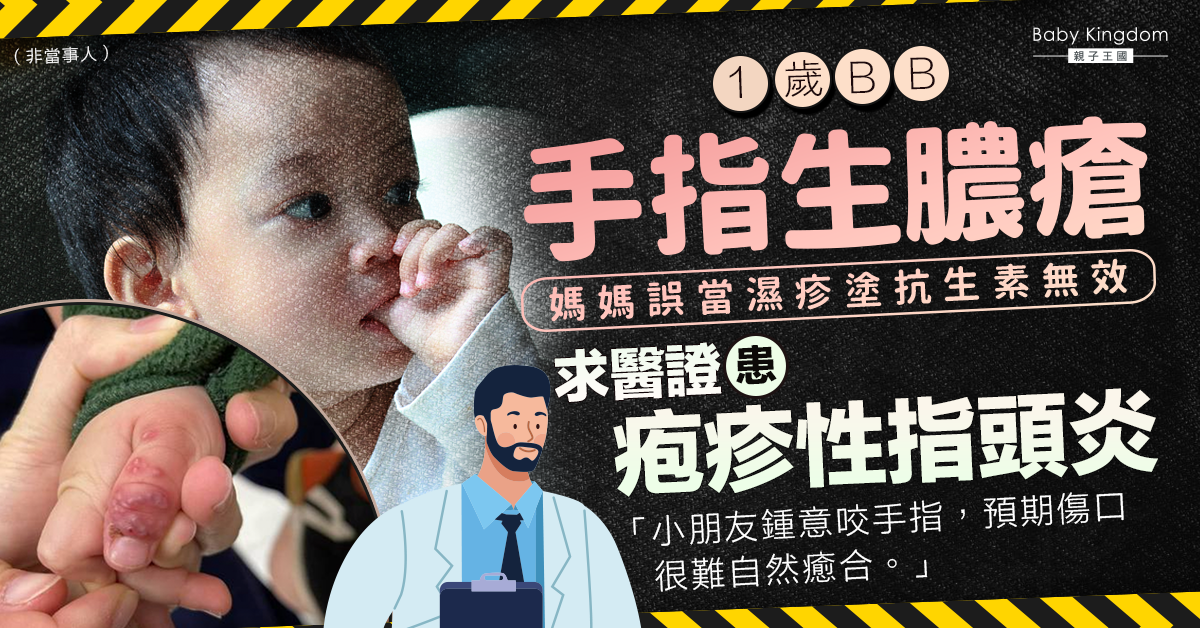 【幼兒健康】1歲嬰兒愛吮手指生膿瘡以為濕疹  求醫揭患疱疹性指頭炎