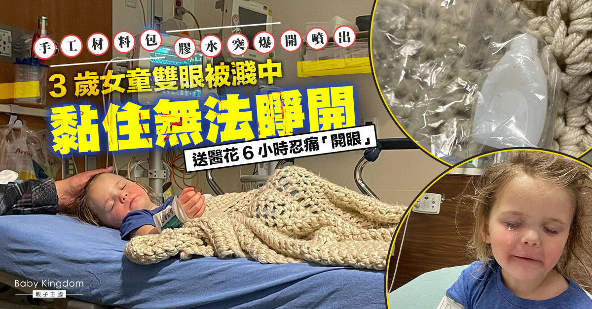 3歲女童做手工膠水突爆開濺中眼臉  雙眼被黏住花6小時忍痛「開眼」
