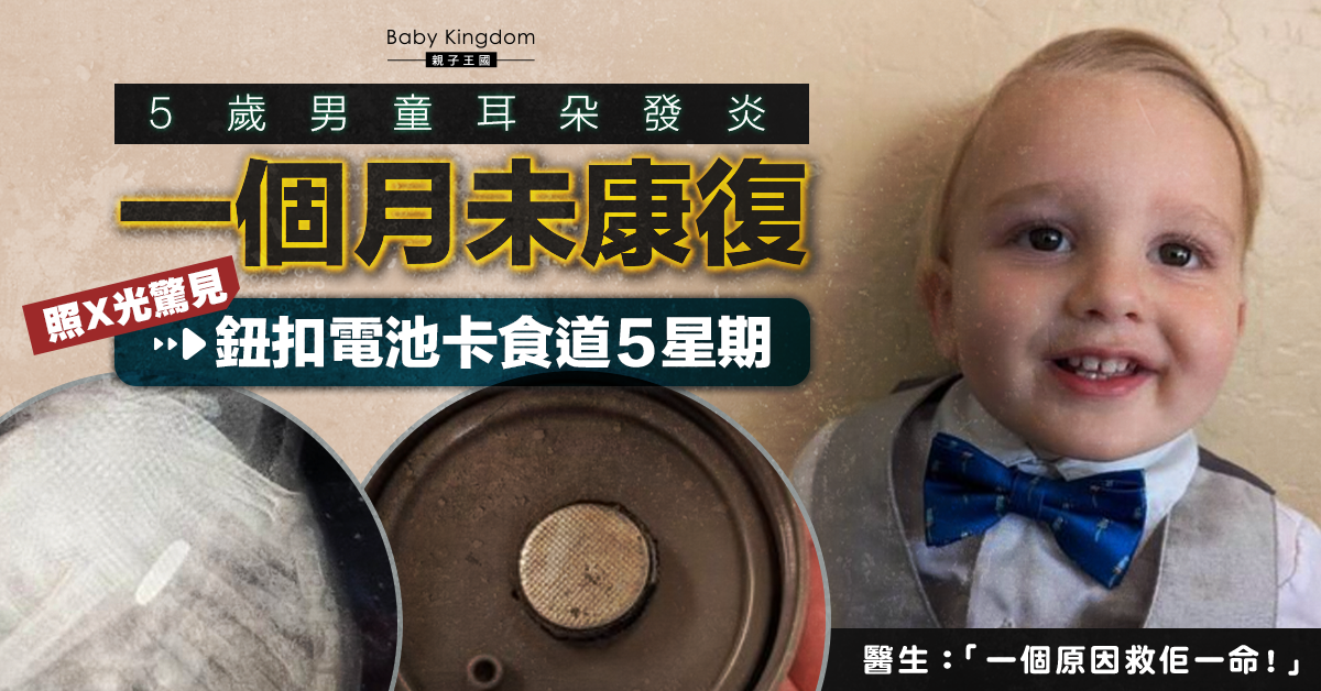 【家長注意】5歲男童吞嚥困難以為耳朵發炎 求醫揭鈕扣電池卡食道5星期