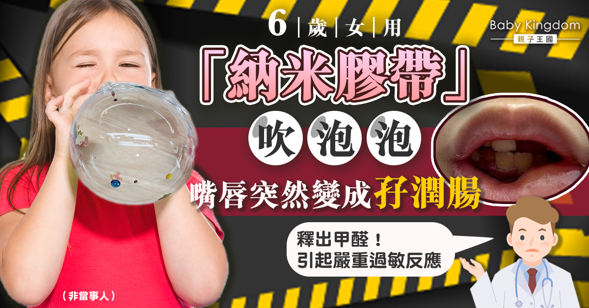 【家長注意】6歲女用納米膠帶吹泡泡釋出甲醛 嘴唇變孖潤腸！