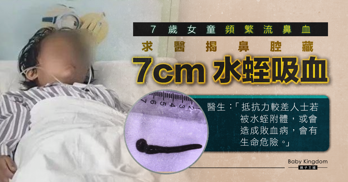 【兒童健康】7歲女童經常流鼻血兼鼻塞 求醫揭水蛭入鼻蠕動吸血
