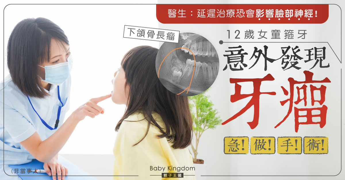 12歲女童矯正牙齒意外發現牙瘤 恆齒無法正常長出