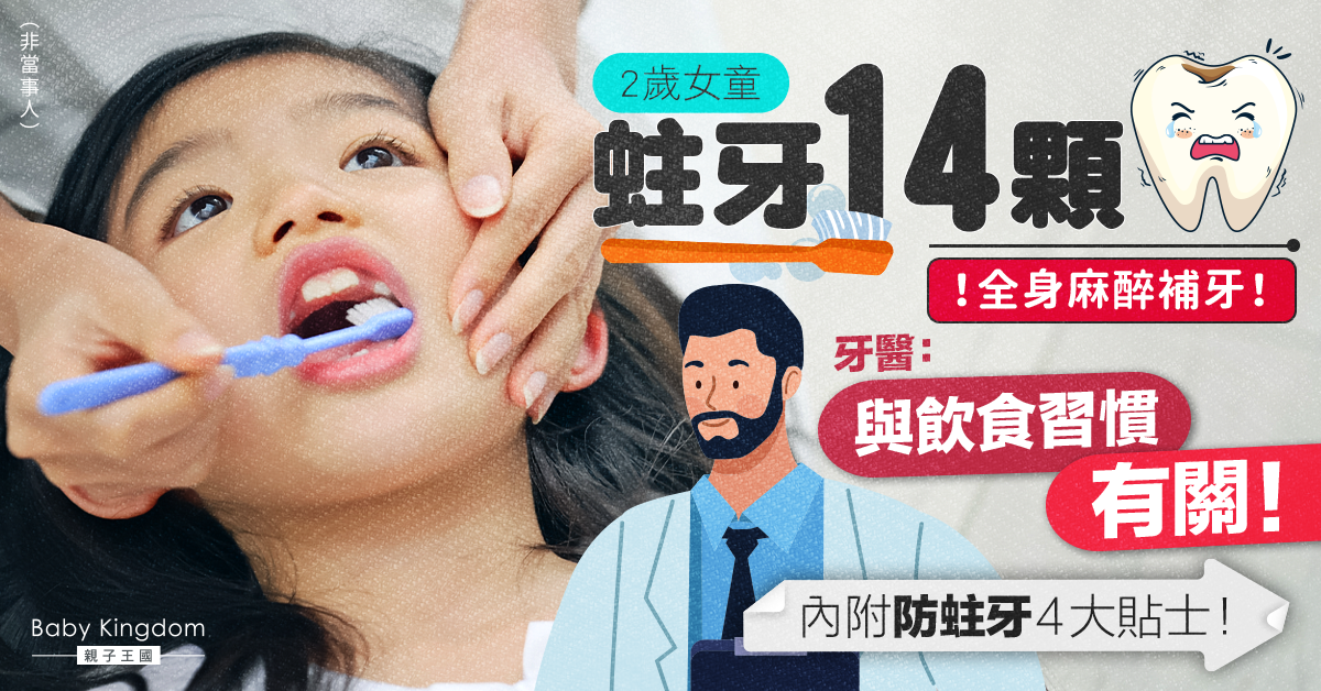 2歲女童蛀牙14顆需全身麻醉補牙  一個習慣增加蛀牙風險！