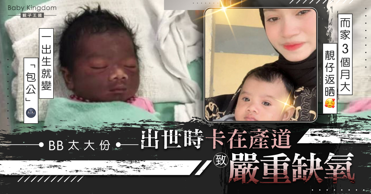 嬌小媽媽懷7.3磅BB 生產過程艱辛BB頭卡產道變「包公」
