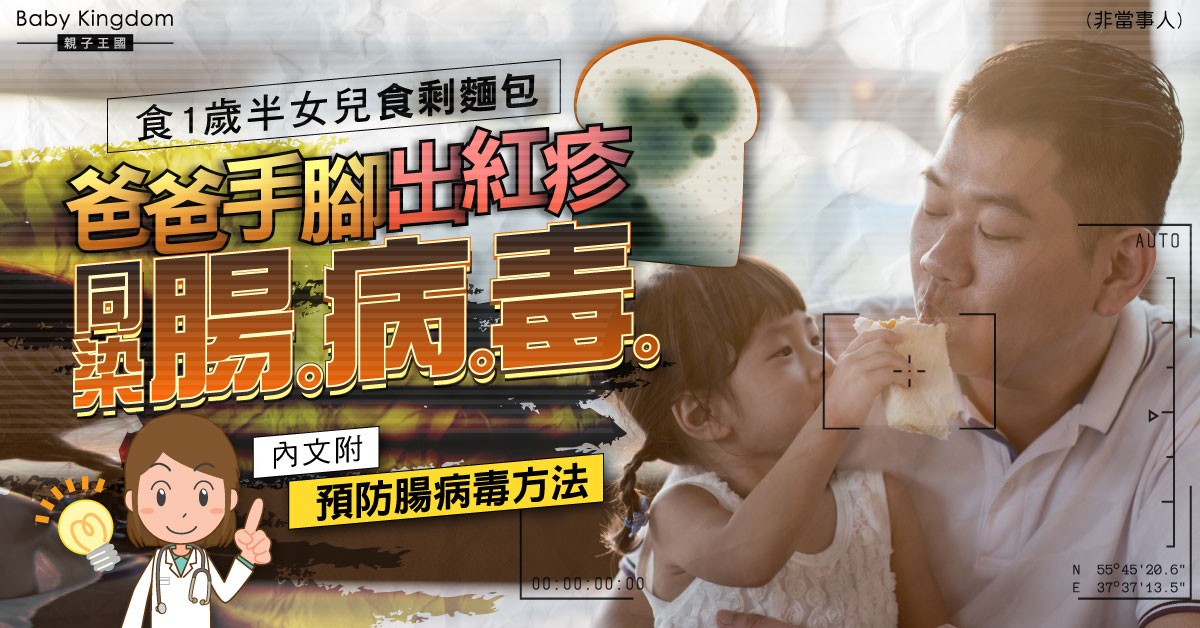 【兒童健康】爸爸食女兒食剩麵包染腸病毒出疹 醫生提醒：勿共食！