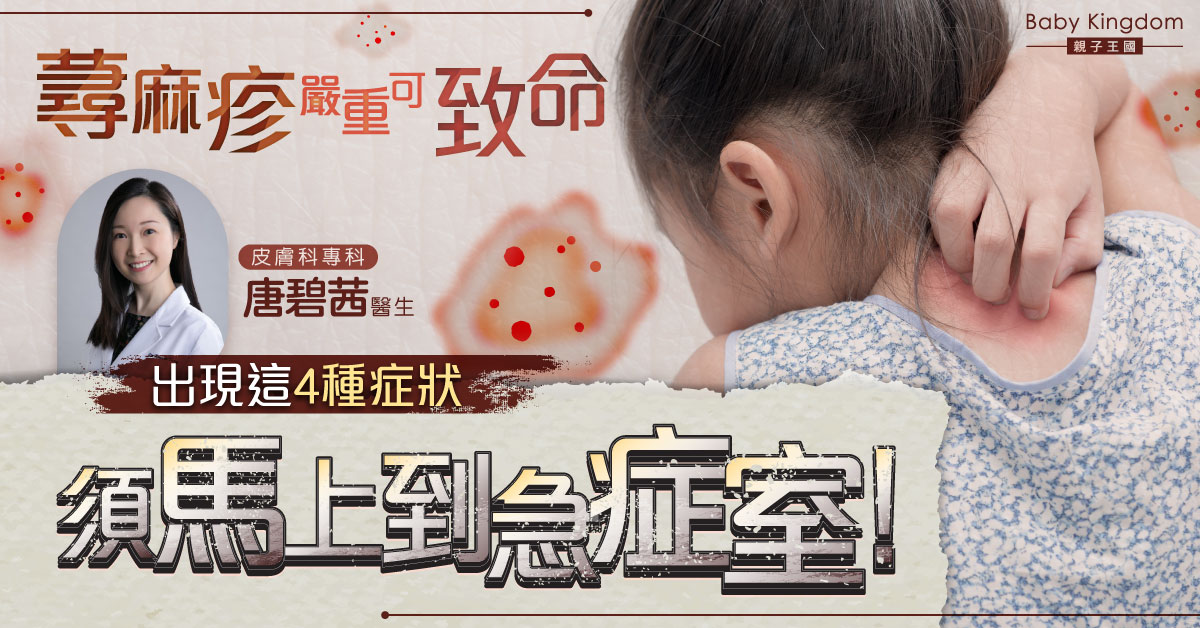 【兒童健康】家長留意!蕁麻疹嚴重可致命 出現這些症狀須求醫