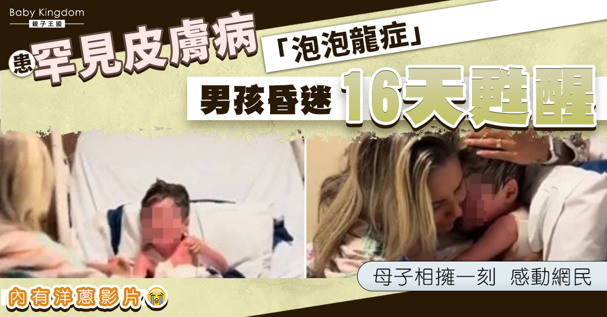 【罕見病】8歲「泡泡龍」男童昏迷16天後甦醒哭著找媽媽 母子相擁一刻哭崩網民