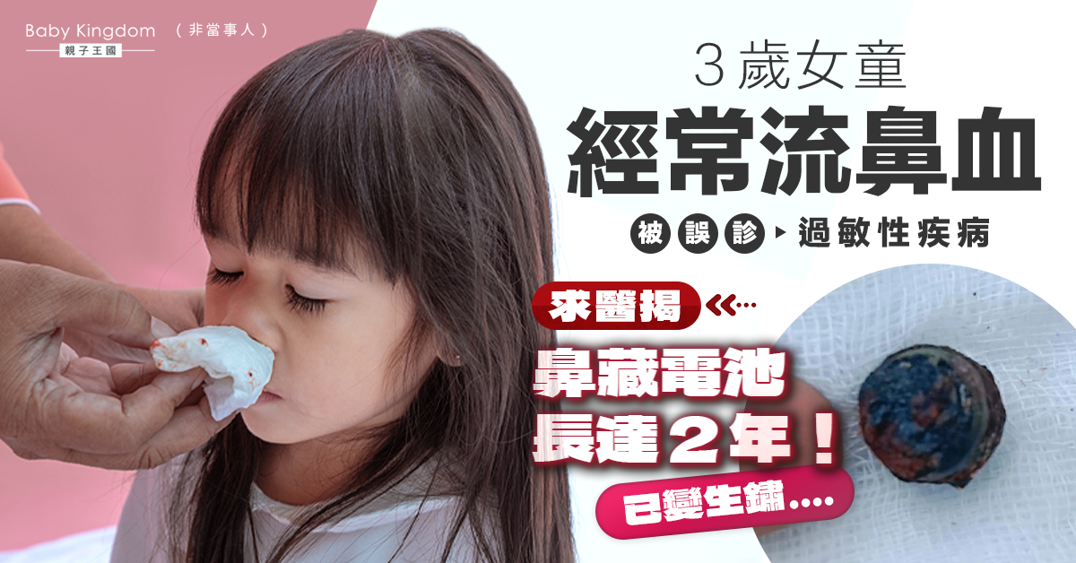 【家居安全】3歲女童經常流鼻血被誤診過敏 求醫揭鼻藏電池長達2年