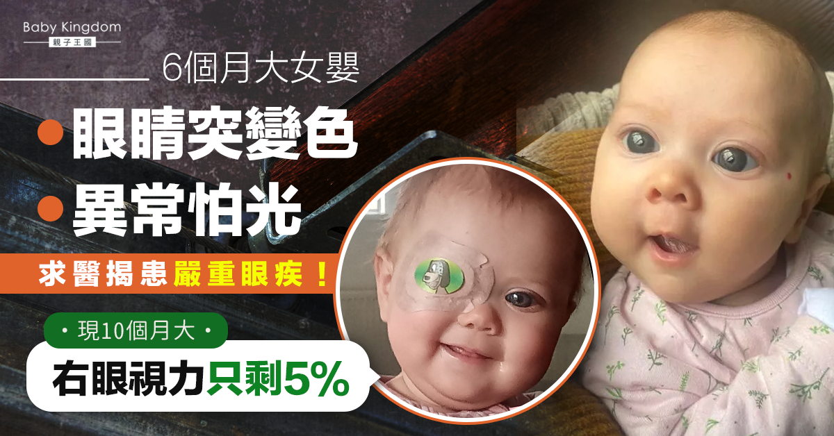 6個月女嬰眼睛突變色異常怕光 母急求醫揭患嚴重眼疾：視力只剩5％