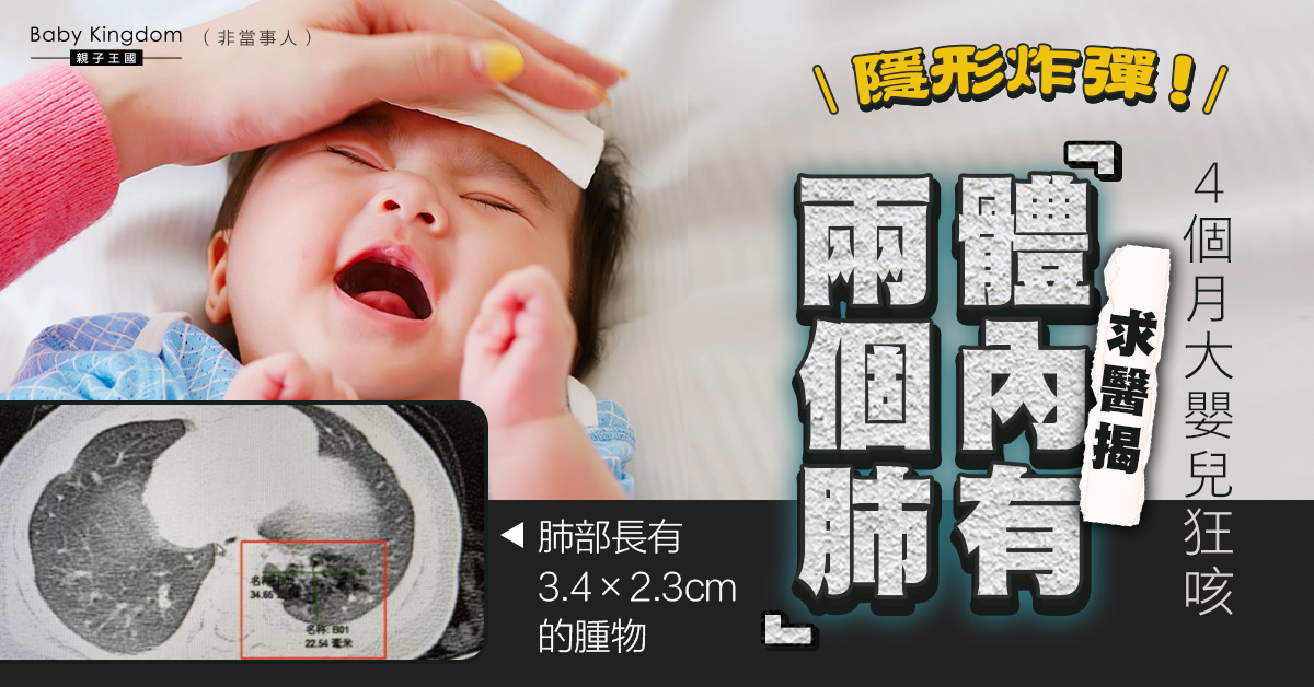 4個月嬰長期嚴重咳嗽 求醫揭罕見體內有「2個肺」