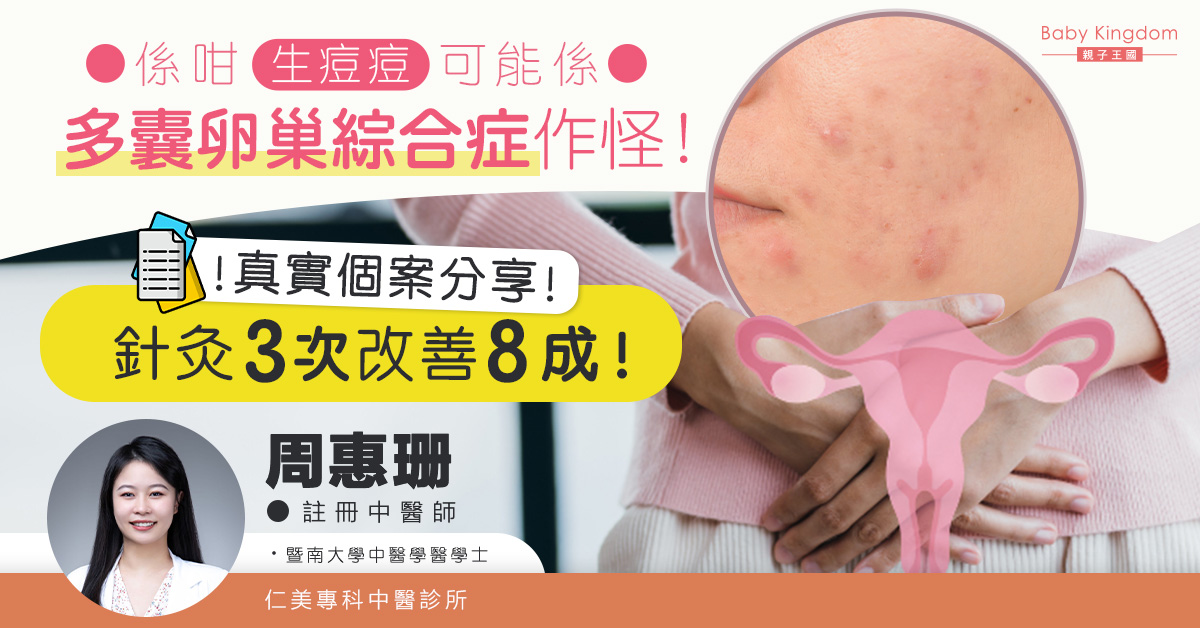 針灸3次已改善8成！面上痘痘不斷可能是多囊卵巢綜合症作怪！
