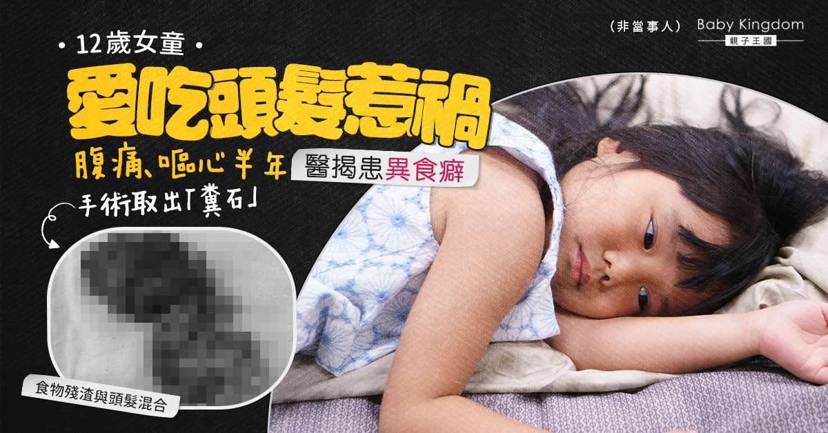 【異食癖】12歲女童愛吃頭髮惹禍 腹痛半年揭患異食癖