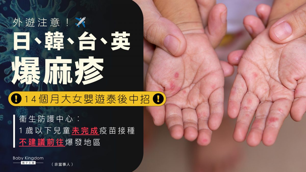 本港錄麻疹確診個案　1歲以下兒童高危　孕婦、外傭要注意！