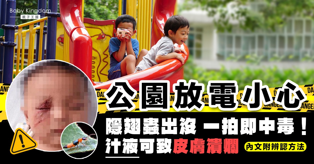【皮膚殺手】勿拍打隱翅蟲！毒液可致皮膚糜爛　常見出沒點是…