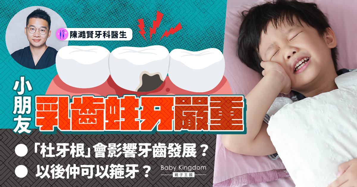 【杜牙根Q&A】小朋友乳齒蛀牙嚴重 「杜牙根」會影響牙齒發展？以後仲可以箍牙？