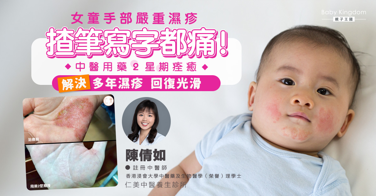女童手部嚴重濕疹揸筆寫字都痛！中醫用藥2星期痊癒解決多年濕疹回復光滑！