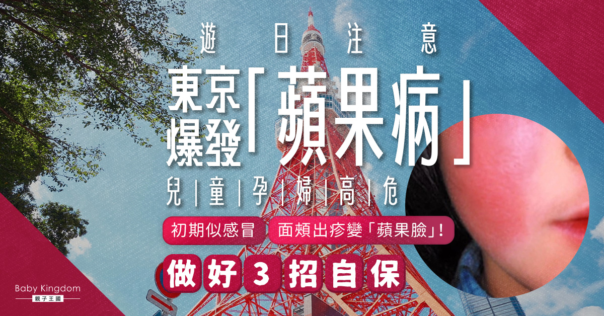 【遊日注意】日本關東爆發「蘋果病」兒童孕婦屬高危人士 做好3招預防措施！