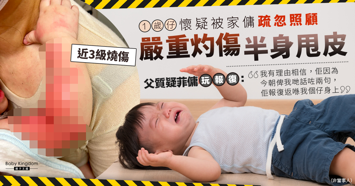 【疏忽照顧】家傭疑疏忽照顧1歲男童令其灼傷半身甩皮 父質疑菲傭受責備後報復