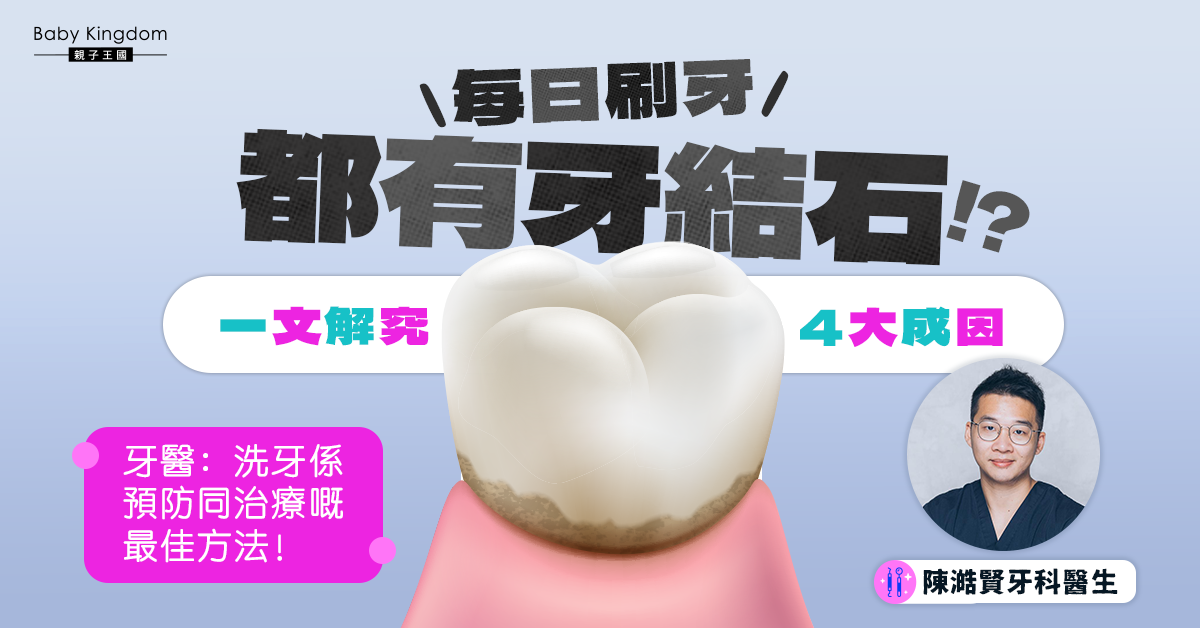 【牙齒健康】牙結石到底是甚麼？洗牙是預防和治療牙結石的最佳方法