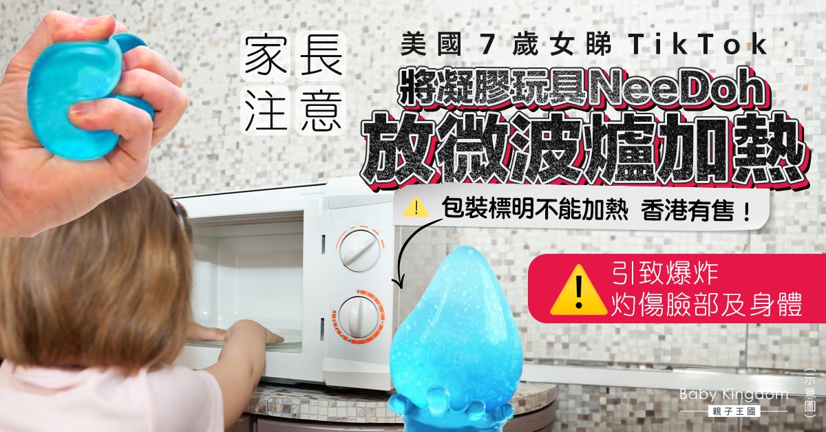 【危險挑戰】7歲女睇TikTok微波爐叮玩具　灼傷身體臉部需麻醉3日
