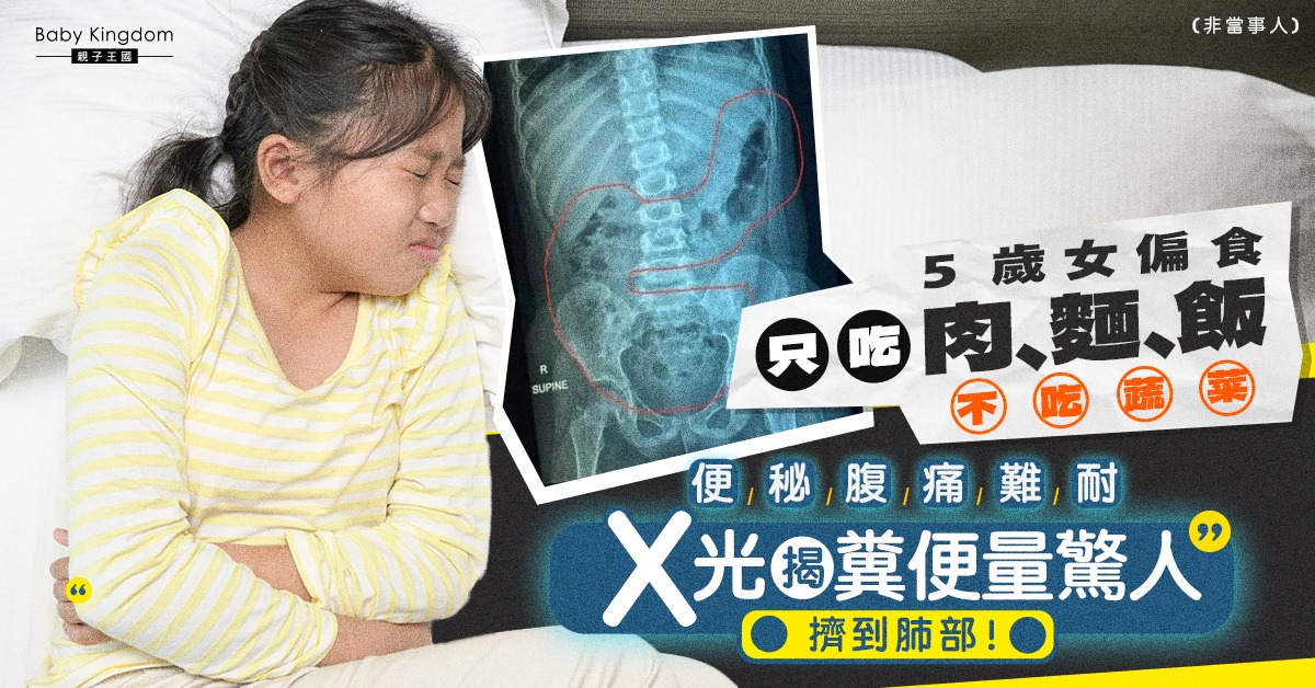 【嚴重便秘】5歲女童不願吃菜　腸積數公斤糞便直迫肺部致劇痛