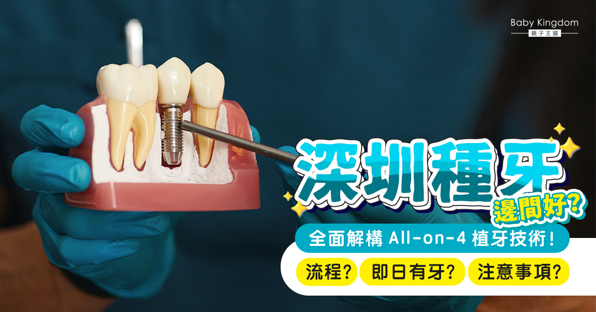 【深圳種牙】深圳種牙技術大揭秘！All-on-4半口種植當日就有牙食飯？