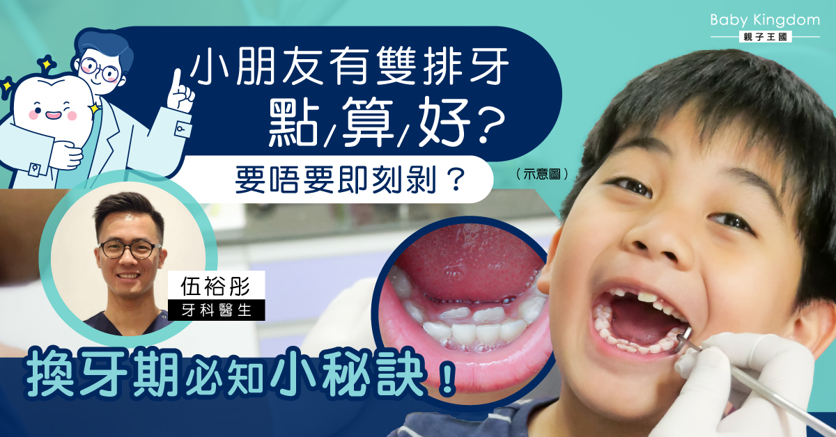 小朋友長雙排牙怎麼辦?該不該拔牙?媽媽們一定要知道的換牙知識!