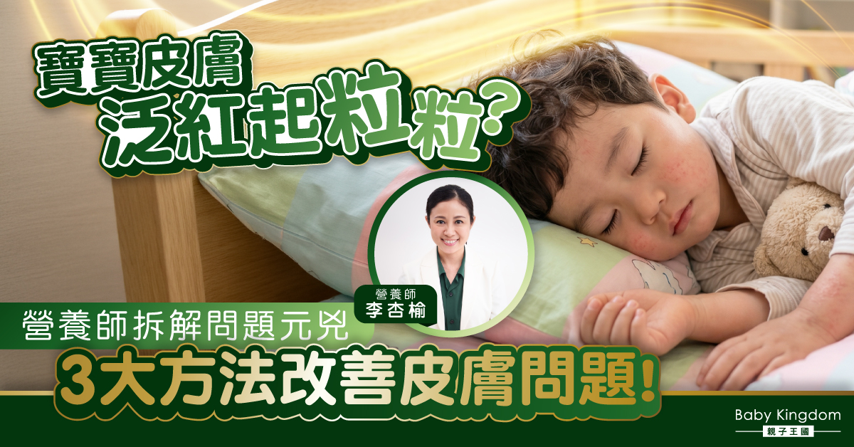 寶寶皮膚護理懶人包！營養師傳授：改善皮膚狀況反覆3大關鍵法則